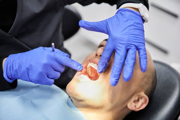 Best Emergency Dental Care for Broken or Chipped Teeth in Acton, CA