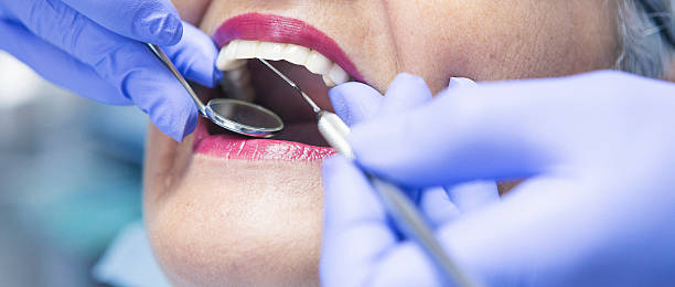 Best Emergency Treatment for Dental Infections or Abscesses in Acton, CA